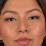 Non Surgical Rhinoplasty Before & After Patient #1313