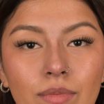Non Surgical Rhinoplasty Before & After Patient #1313