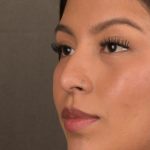 Non Surgical Rhinoplasty Before & After Patient #1313