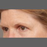 Daily Skin Care Before & After Patient #1321