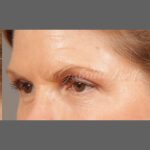 Daily Skin Care Before & After Patient #1321