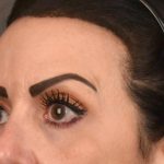 Brow Lift Before & After Patient #3294
