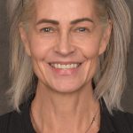 Facelift Before & After Patient #4123
