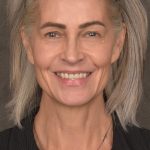 Facelift Before & After Patient #4123