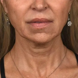 B&A