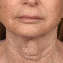 B&A
