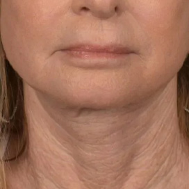 B&A