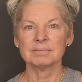 B&A